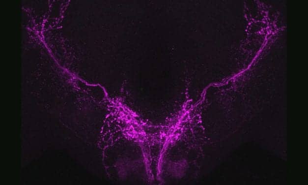 Sleep May Help Animals Adapt to New Situations, Suggests Fruit Fly Study
