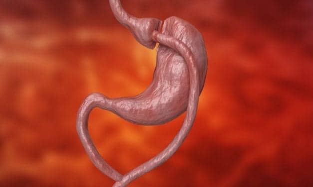 Society: Resume Bariatric and Metabolic Surgery Before COVID-19 Pandemic Is Over