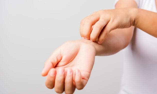 Chronic Itch Linked to Sleep Loss—& Possible Signal of Increased Heart Disease Risk