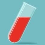 This Simple Blood Test Can Help Predict Cardiometabolic Disease Risk in OSA Patients