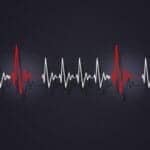 Atrial Fibrillation Isn’t the Only Type of Arrhythmia Linked to Sleep Apnea
