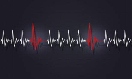 Atrial Fibrillation Isn’t the Only Type of Arrhythmia Linked to Sleep Apnea