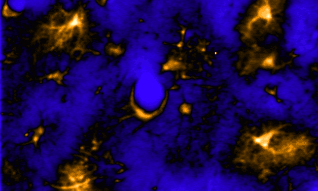 Do Astrocytes Change Dynamically Across Sleep & Wake States Like Neurons Do?