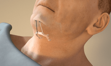 Hyoid Suspension + UPP Is Efficacious For Multilevel Obstructive Sleep Apnea Patients