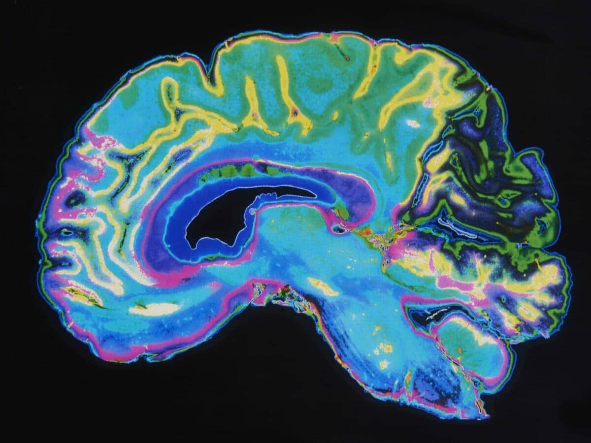 Sleep Brain Waves Can Help Diagnose Dementia | Sleep Review