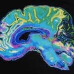Scientists Are Designing a ‘Sleep Cap’ to Measure Metabolic Waste Disposal During Sleep