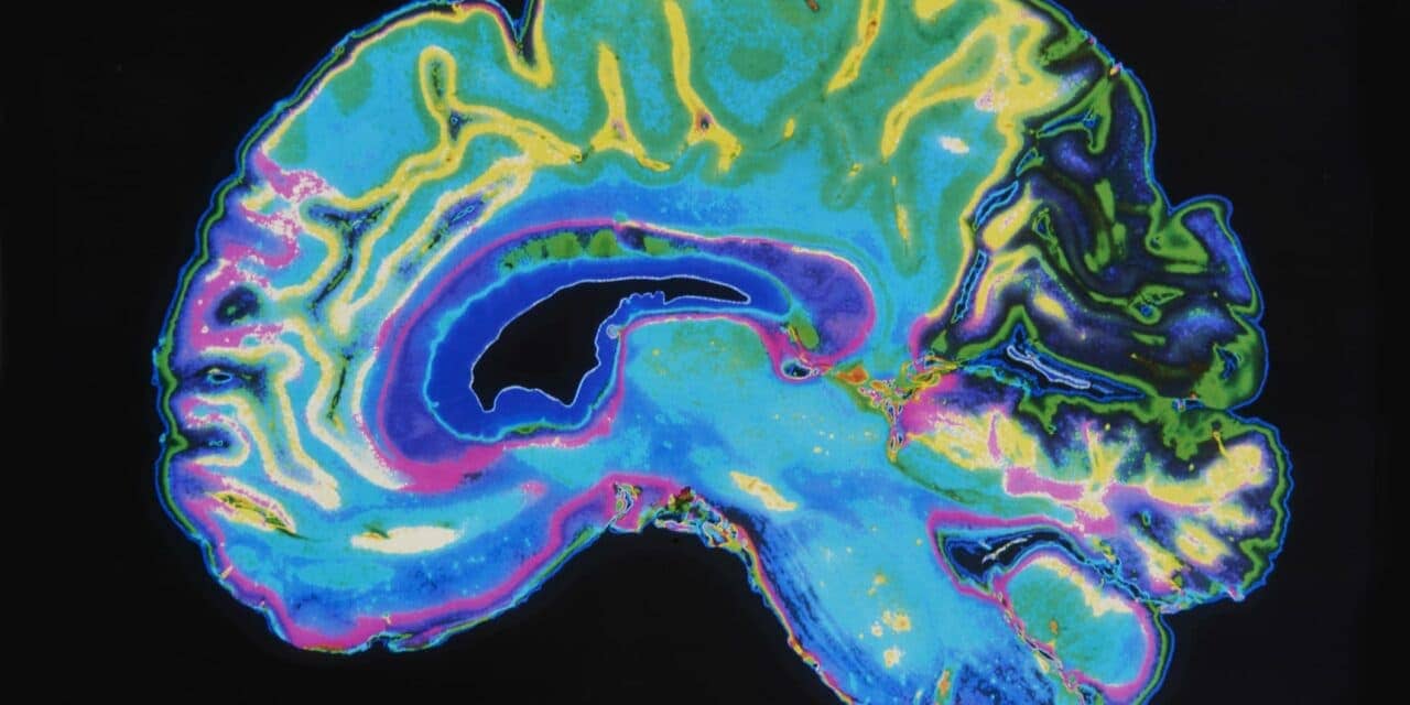 This Is How Poor Sleep Habits Impact Preteens’ Brains