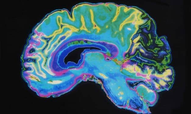 This Is How Poor Sleep Habits Impact Preteens’ Brains