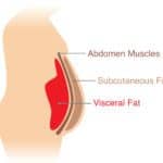 Lack of Sleep Increases Abdominal Visceral Fat