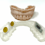 Oral Appliance Sensors Will Soon Rival Sleep Studies in Their Data Collection