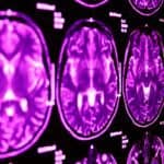 How Daytime Sleep Changes Memories of Emotional Trauma