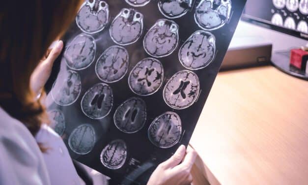 Does Insomnia Influence Memory Decline in Older Adults?