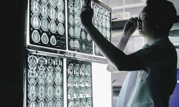Does Sleep Time and Duration Affect Dementia Risk?