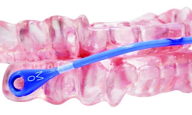 SOMNOMed Treats 740,000-Plus Patients, Sees Q1 Revenue Growth