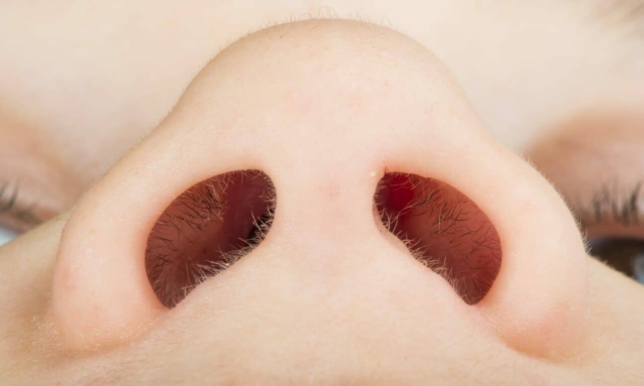 NasoClenz: Does Nasal Cleansing Increase Compliance in CPAP Patients?