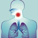 A Potentially Huge CPAP Pressure Mistake