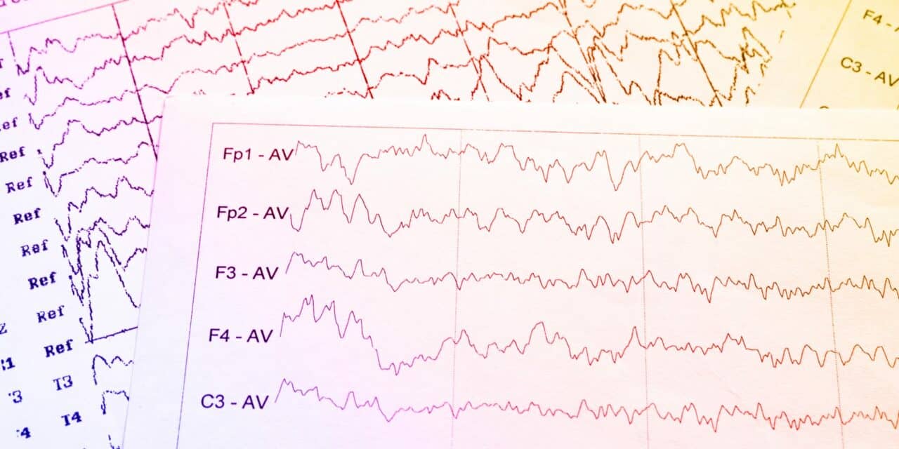 Update: Investigational Drug for Epileptic Encephalopathy with Spike-and-Wave During Sleep