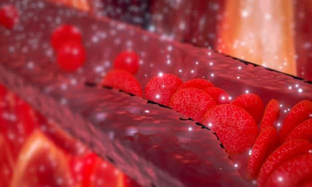 Short Sleep Significantly Raises Risk of Peripheral Artery Disease