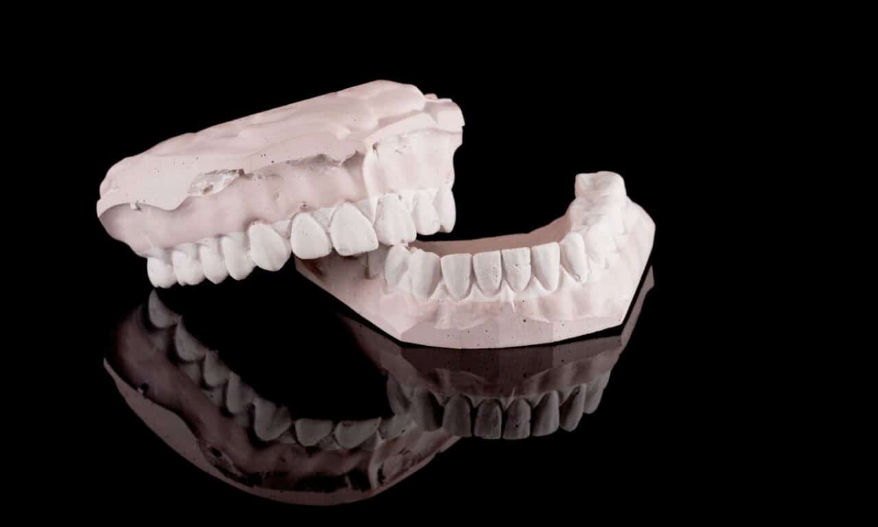 This Dental Device Was Sold to Fix Patients’ Jaws. Lawsuits Claim It Wrecked Their Teeth.