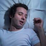 Investigational OSA Approach Sidelines CPAP