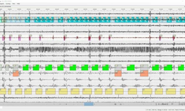 Study Confirms Efficacy of HoneyNaps’ AI Sleep Diagnostic Tool