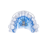 Vivos’ DNA Oral Appliance Enters Clinical Showdown With CPAP 
