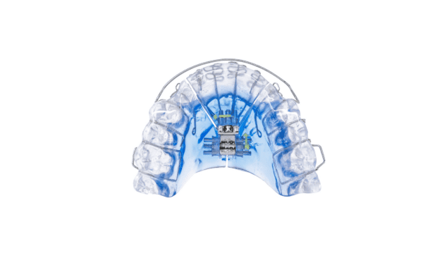 Vivos’ DNA Oral Appliance Enters Clinical Showdown With CPAP 