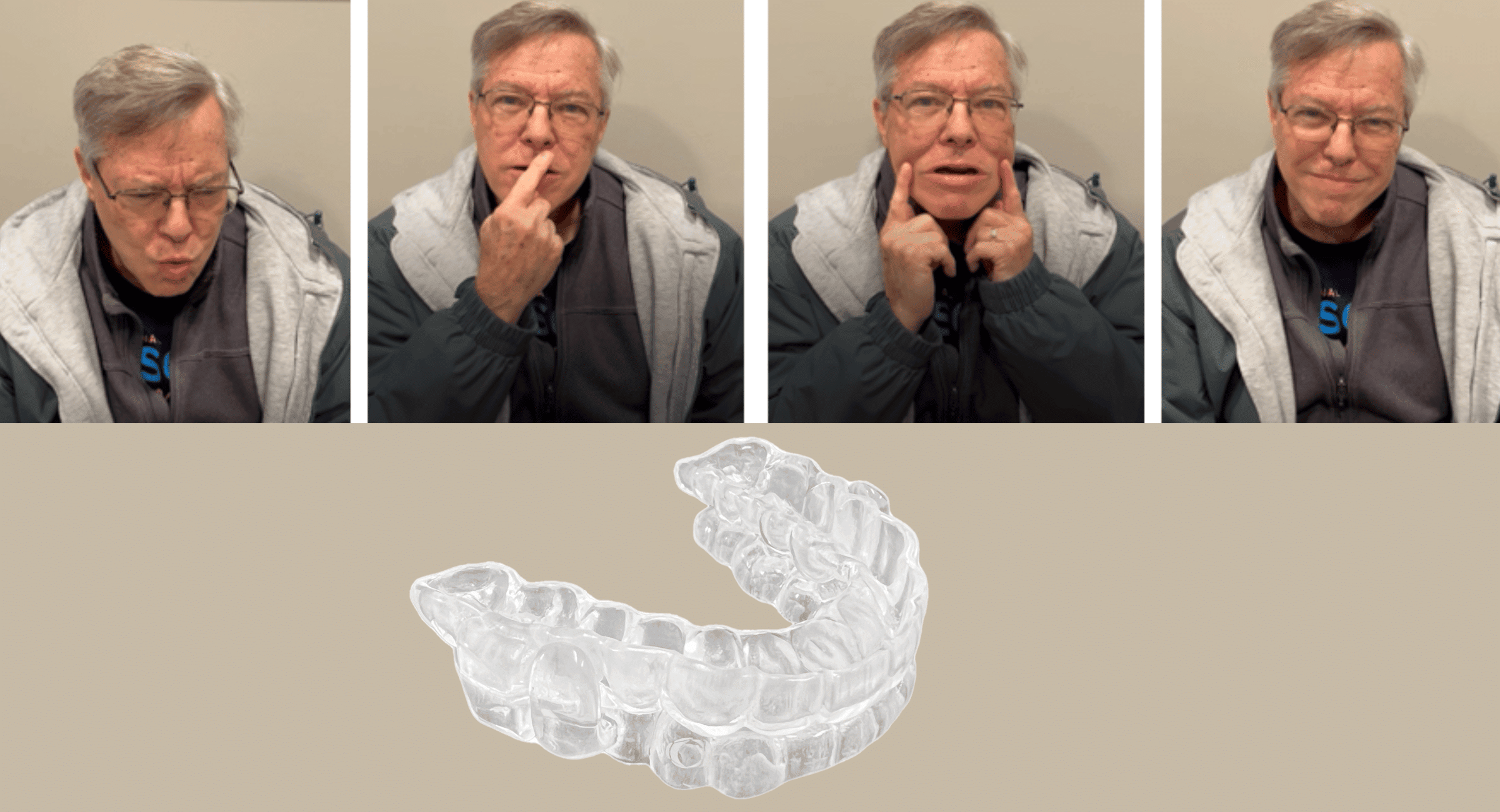 Two-piece mandibular advancement device without elastic retention band