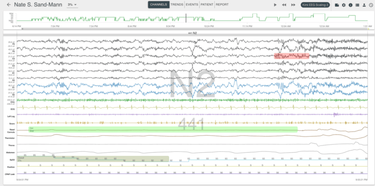 EnsoSleep Sleep Scoring