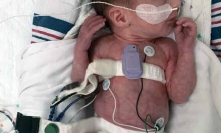 Wearable Device Aids in Detecting Apneas in Premature Infants