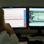 AI Tool Aims to Ease Detection of REM Sleep Behavior Disorder