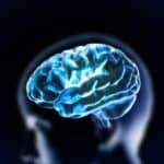 Is It Idiopathic Hypersomnia or Narcolepsy? Brain Imaging May Hold Answers