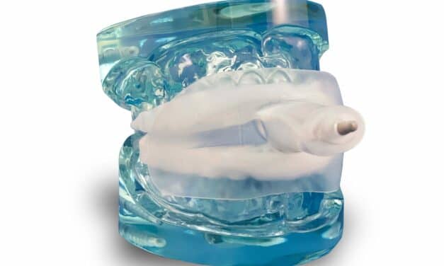 myTAP Oral Appliance Now Available Through Sleep Doctor