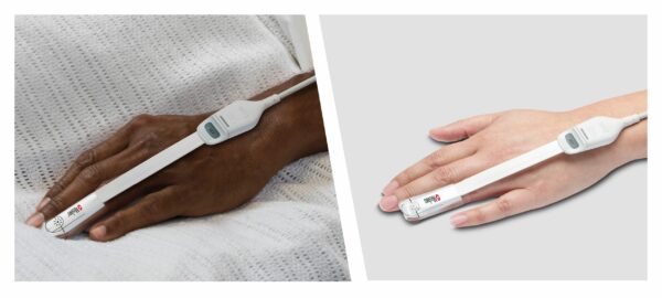 Masimo Validates Oximetry in Low Perfusion Conditions for Black and White Skin Tones