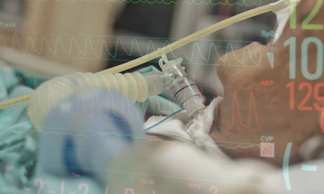 New Clues to Mechanical Ventilation Weaning Failure