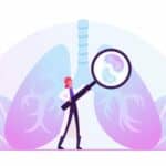 From CPAP to Custom Care for Obstructive Sleep Apnea