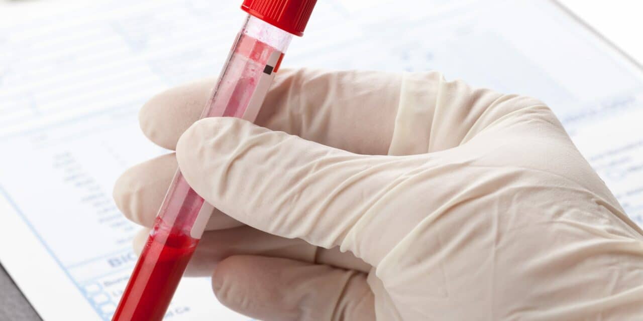Could a Simple Blood Test Hold the Secret to Sleep Apnea Risk?