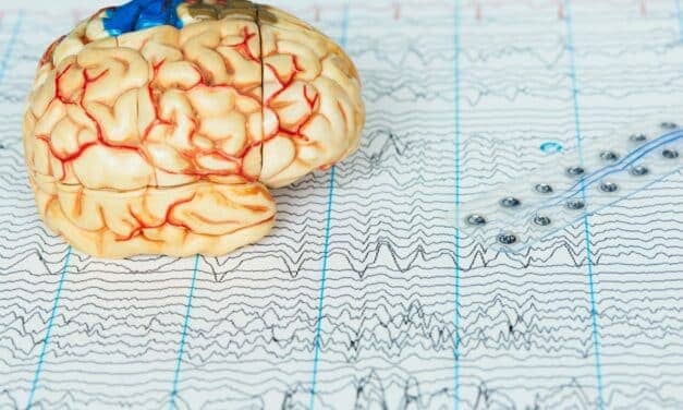 Sleep-Based Dementia Research Advances with New Grant Funding