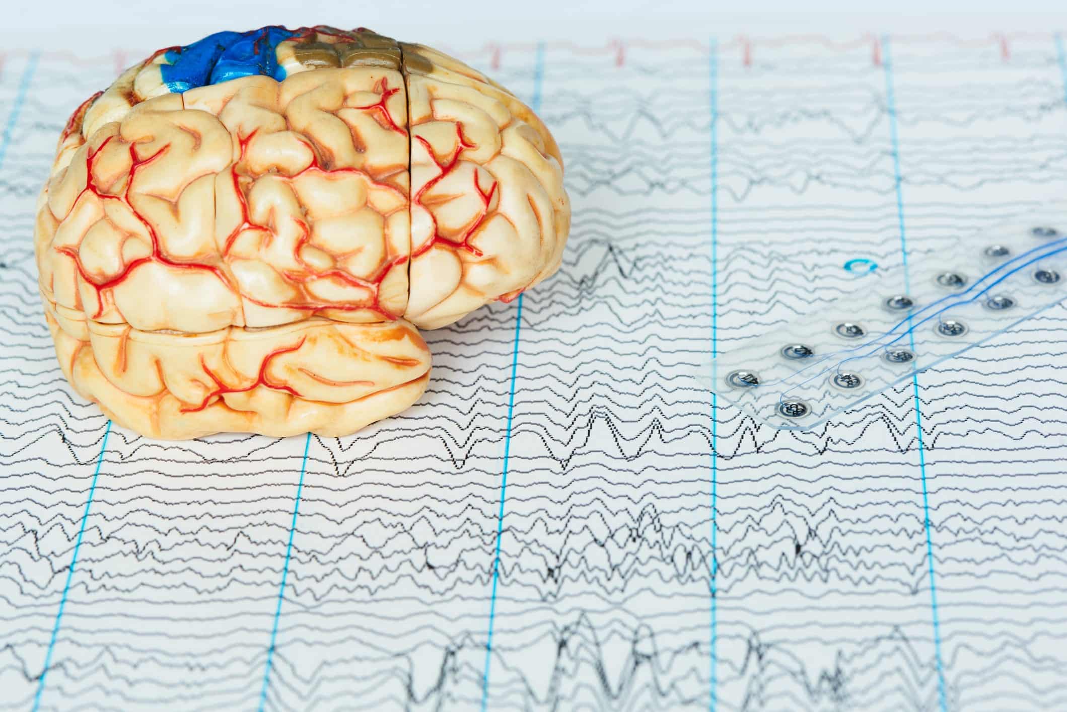 Sleep-Based Dementia Research Advances with Grant Funding