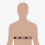 Single-Lead ECG-Based Sleep Test on Par With Polysomnography 