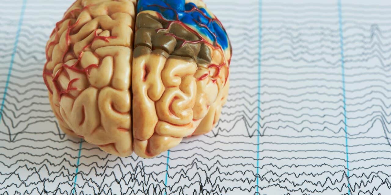 Cerebra Launches MY ORP to Enhance EEG-Based Sleep Studies