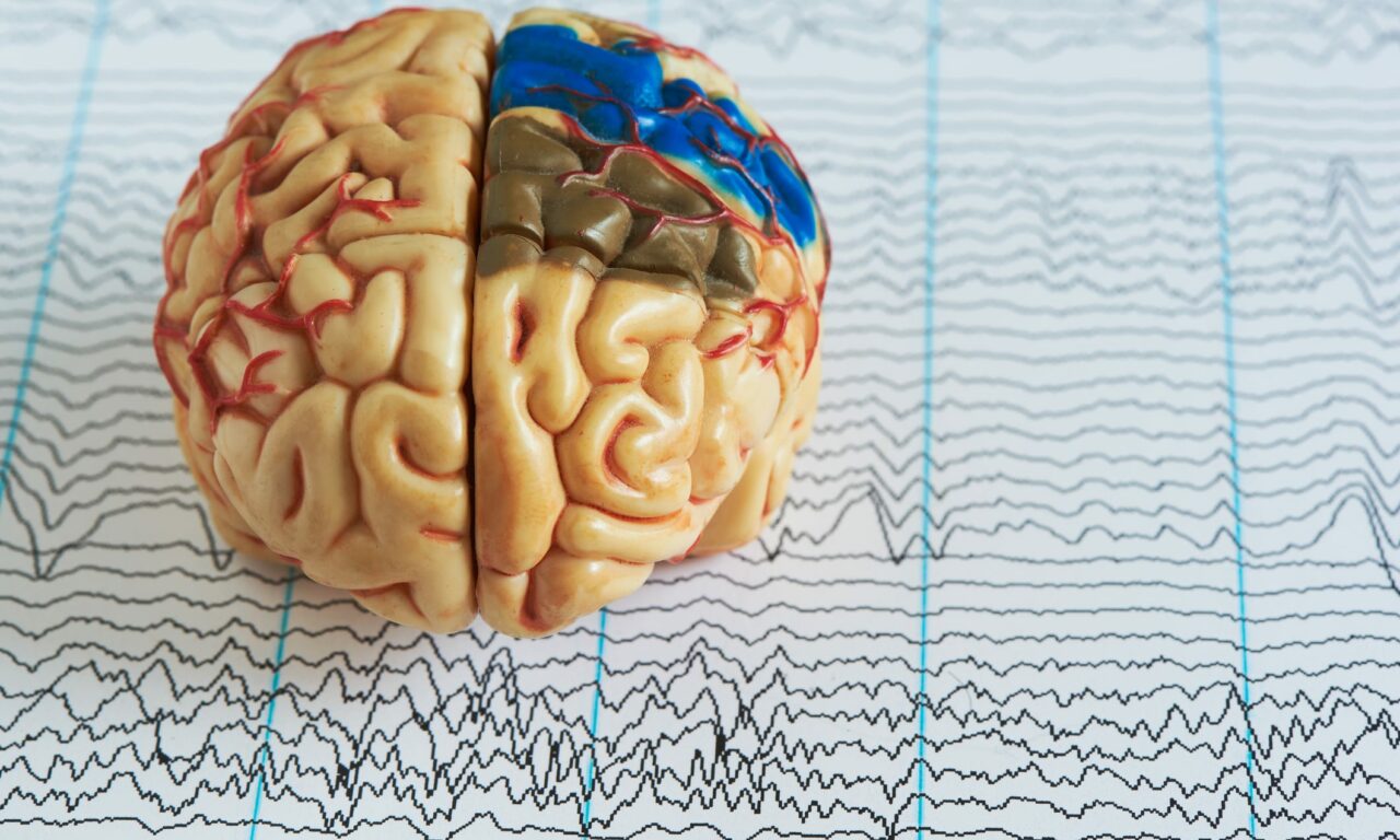 Cerebra Launches MY ORP to Enhance EEG-Based Sleep Studies