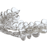 SICAT Simplifies Oral Appliance Ordering and Enhances 3D Imaging Capabilities