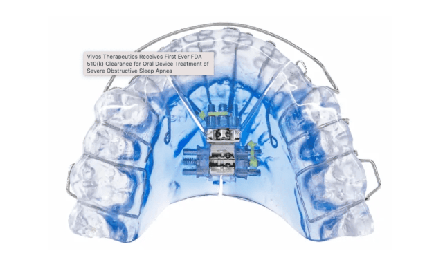 After Success with a Sleep Center Partnership, Oral Appliance Maker Vivos Explores ‘Outright Acquisitions of Sleep Centers,’ More Alliances