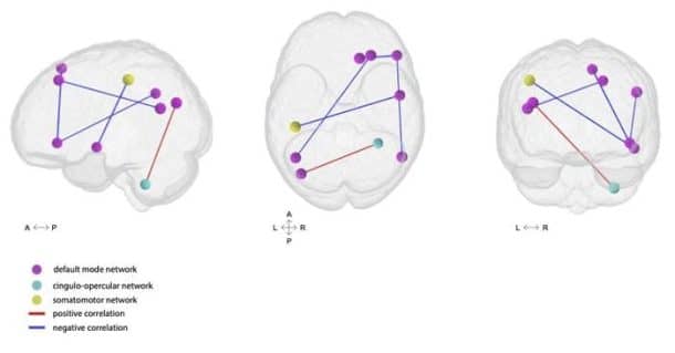 Why a Bad Night’s Sleep Can Impact You Well Into Next Week