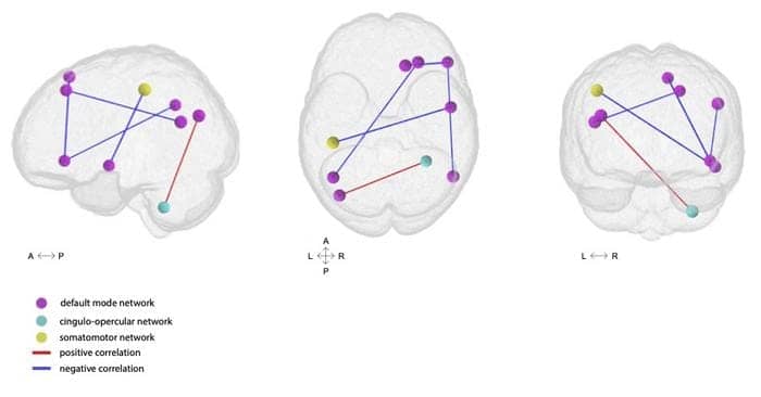 Why a Bad Night’s Sleep Can Impact You Well Into Next Week