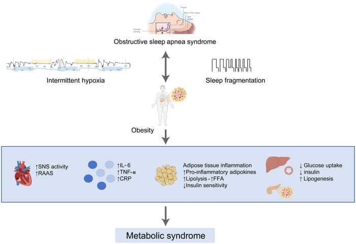 ​​How OSA, Obesity, and Metabolic Syndrome Interact to Increase Cardiovascular Risks