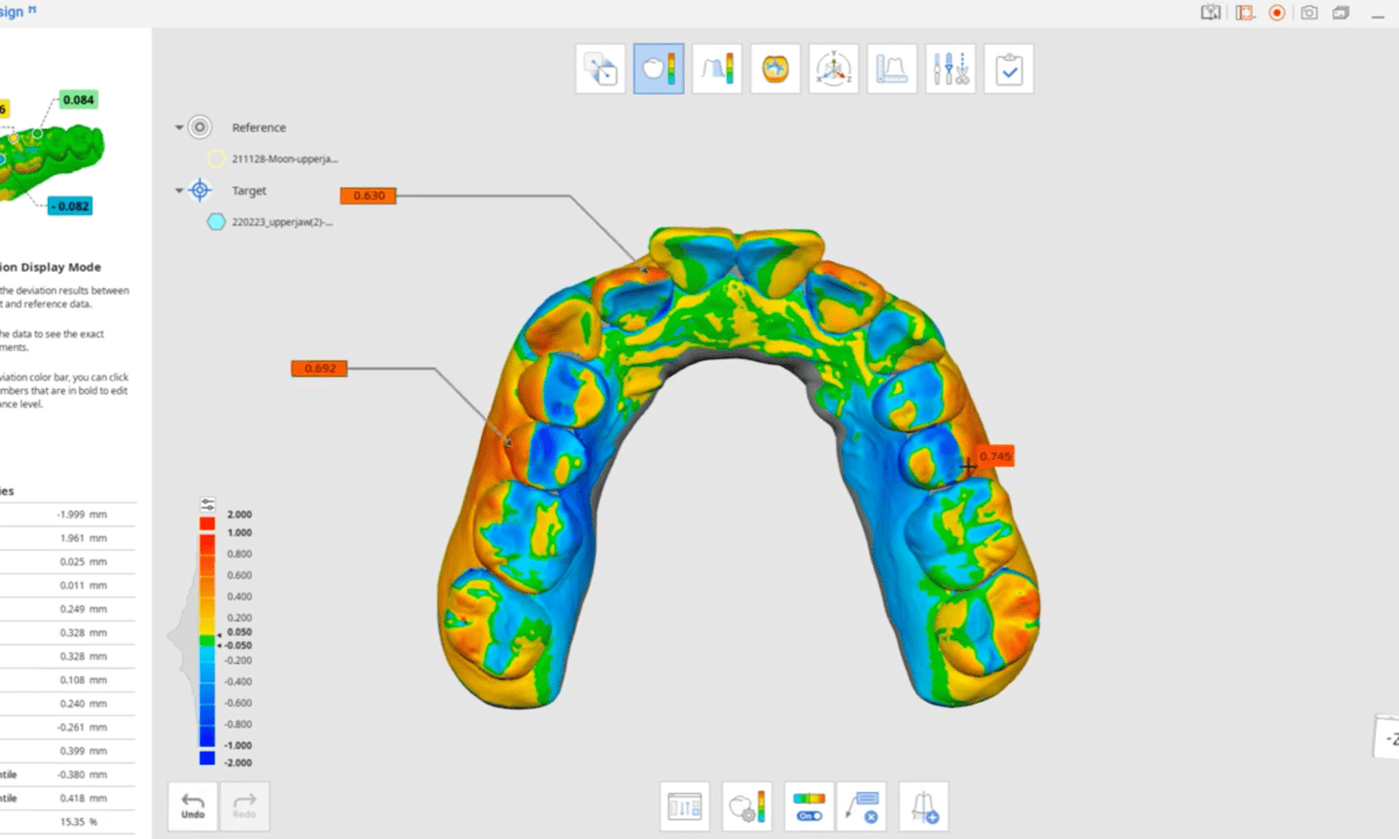 A New Way to Quantify Bite Changes in Oral Appliance Therapy