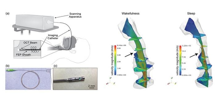 Optical Imaging Technique May Offer Clearer View of Sleep Apnea