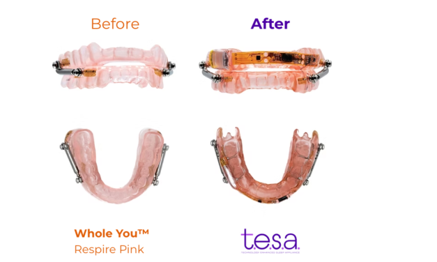 Smart Sensors for Oral Appliance Therapy Monitoring Debut at CES
